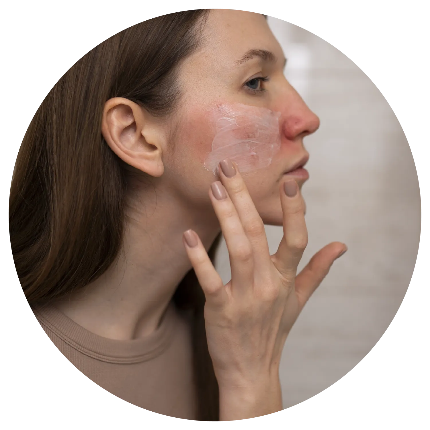 Rosacea treatment process at Toronto medical spa - Understand what's triggering your skin.